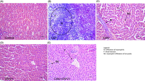 Figure 4. Representative photomicrographs of liver sections from Wistar rats exposed i.p. to 1 mg CdCl2/kg BW/day (for 21 and 42 days) and orally to 178.5 mg DSF/kg BW/day (for 21 days), individually and/or in combination: (A) Control/intact group, showing normal appearance; (B) Cd21: showing infiltration of neutrophils (N) and focal necrosis (F). (C) Cd42: showing infiltration of neutrophils (N) and neutrophil infiltration of sinusoids (NS). (D) DSF21: showing normal appearance; and (E) Cd42 + DSF21: group showing infiltration of neutrophils (N), neutrophil infiltration of sinusoids (NS) and focal necrosis (F).