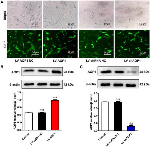 Figure 1 Efficiency of lentivirus-mediated AQP1 overexpression or silencing in MH7A cells. (A) GFP expression was observed in the infected MH7A cells by a fluorescence microscopy at 72 h after infection (×100). (B) Results of Western blot revealed the increased AQP1 expression in LV-AQP1 group. (C) Results of Western blot revealed the reduced AQP1 expression in LV-shAQP1 group. The data are mean ± SEM of three independent experiments performed in triplicate. n.s. compared with non-transfected control group. **P < 0.01 compared with LV-AQP1 NC group. ##P < 0.01 compared with LV-shRNA NC group.