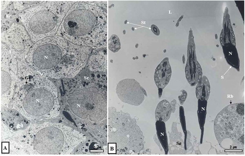 Figure 3. Electron micrographs showing early Golgi phase (June experiment group) and spermiation phase (September experiment group). In the cytoplasm of spherical sperm cells, there were abundant mitochondria and smooth endoplasmic reticulum (sER), including well-developed Golgi complexes (Gc) (A). In addition, many spermatozoa were observed in the lumen, including sperm in the cytoplasm of Sertoli cells (B). L, lumen; N, nucleus; Rb, residual body; S, sperm; Se, Sertoli cell; St, sperm tail.