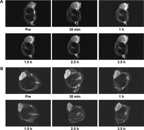 Figure 6 (A) and (B) respectively represent T2-weighted images in MRI (3.0 T) of tumors in vivo before and after injection of saline solution and A-MFS.Notes: The images were obtained at the following time points: before injection, 30 minutes later, 1, 1.5, 2.5, and 3.5 hours after injection. The tumor signal decreased after injection of A-MFS. When injected for 2.5 hours, the T2-weighted signal values decreased to the lowest level. The signal remained almost constant after injection of saline solution.Abbreviations: A-MFS, Fe3O4@SiO2 modified with anti-mesothelin antibody; MRI, magnetic resonance imaging; min, minutes; h, hours.