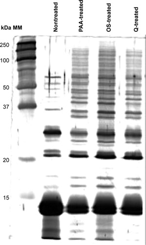 Figure 1 SDS-PAGE of nontreated and NP-treated RBC lysates.Notes: The same quantity of proteins was loaded on gel for the different tracks. We can see the diminution of hemoglobin proportion in NP-treated samples for which we can distinct two bands corresponding to alpha and beta hemoglobin subunits (around 14 kDa).Abbreviations: SDS-PAGE, sodium dodecyl sulfate-polyacrylamide gel electrophoresis; NP, nanoparticle; RBC, red blood cell; MM, molecular markers.