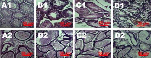 Figure 7. Representative photomicrographs of testes and epididymis from control and VCD-treated rats. Control testes (A1) and epididymis (A2) showed normal morphology. Treatment-related lesions such as mild congestion, edema and reduced sperm numbers in the testes of 100 mg/kg VCD-treated rats (B1) whereas 250 and 500 mg/kg VCD-treated rats showed marked degeneration of the seminiferous tubules (C1 and D1). Epididymis of 100 and 250 mg/kg VCD-treated rats showed lumen with few viable sperm cells (B2 and C2) whereas 500 mg/kg VCD-treated rats showed reduced epithelia layer integrity with some empty lumen (D2).