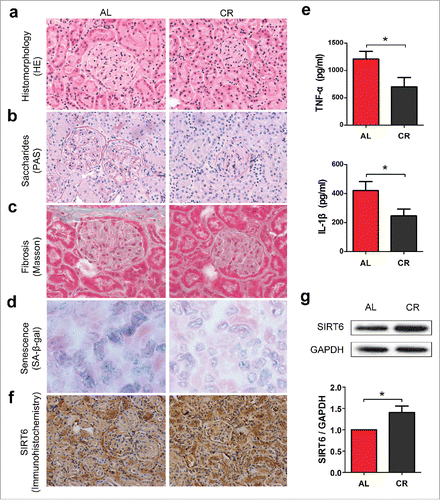 Figure 1. CR enhances SIRT6 expression and improves renal pathologies. (a) Aged male mice were fed under either Ad libitum (AL, n = 10) or caloric restriction (CR, n = 7) diet for 6 months. HE staining (×200) was applied to test renal histomorphology. (b) PAS staining (×200) was used to determine saccharides level. (c) Masson staining (×400) were applied to detect severity of renal fibrosis. (d) SA-β-gal assay (×200) was used to test the expression of senescence-associated β-galactosidase. (e) The level of renal tumor necrosis factor-α (TNF-α) and interleukin-1β (IL-1β) were measured by ELISA in both groups. (f) Immunohistochemistry (×200) and (g) Western blot analysis was applied to measure SIRT6 expression in mice kidney under AL or CR diet. *p < 0.05.