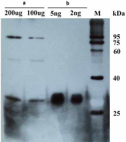Figure 8. The purified MsPYR1 protein and seed protein was detected by western blotting analysis. A: M. sieboldii seed protein. B: MSPYR1 recombinant protein. M: protein molecular weight marker