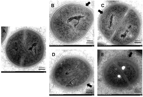 Figure 3 Ultrastructural morphology of S. aureus ATCC 29213 observed using transmission electron microscopy after treatment with (A) the untreated control, (B) 1 x MIC XF-73 for 2 min, (C) 1 x MIC XF-73 for 10 min, (D) 4 x MIC XF-73 for 2 min, or (E) 4 x MIC XF-73 for 10 min. Scale bar = 200nm. Arrows refer to the damaged bacterial cell walls or cell membranes.