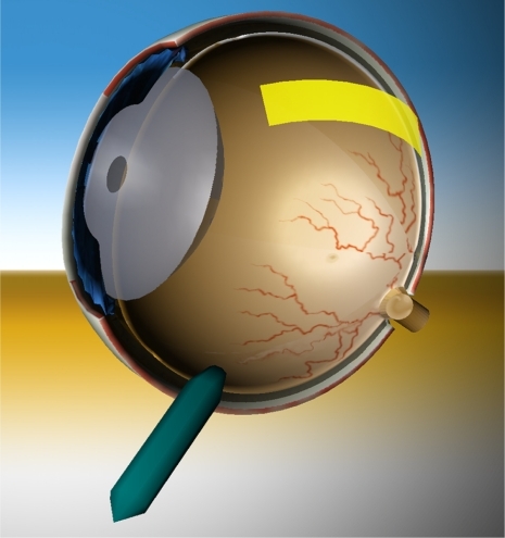 Figure 4 Interactive stereoscopic 3D eye model.