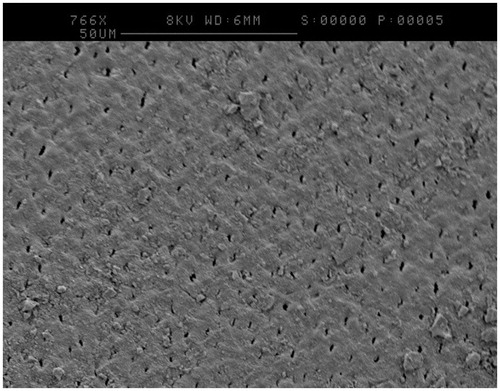 Figure 2. SEM image of a CSPS plus fluoride treated sample following incubation showing occluded tubules and an altered surface layer.