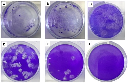Figure 3. Quantification of SARS-CoV-2 in CCL-81 cell culture. Plaque assays were performed on the harvested virus at 62 h post-infection, fixed, and stained with crystal violet to visualize. A, B, C, D, E wells are ten-fold dilutions of virus (10−3–10−7) and F well is the negative control.
