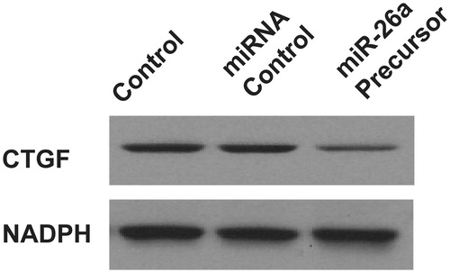 Figure 6. miR-26a inhibited CTGF expression. Western blotting analysis of CTGF protein level. GAPDH was used as a loading control.