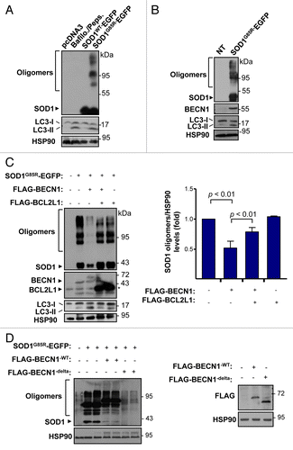 Figure 6. BECN1 expression reduces SOD1 levels in a motoneuron cell line. (A) NSC34 cells were transiently transfected with expression vector for human wild-type and mutant SOD1G85R fused to EGFP. After 72 h, SOD1 levels were monitored in cell extracts prepared in 1% Triton X-100 buffer by western blot. LC3-II levels were also measured in the same samples. As a control, NSC34 cells were treated with 200 nM bafilomycin A1 (Bafilo.) and 10 mg/ml pepstatin (Peps.) lysosome inhibitors for 16 h to induce LC3-II accumulation. (B) Levels of BECN1 and LC3-II were evaluated in cells after transient transfection of NSC34 cells with the mutant SOD1G85R–EGFP vector. HSP90 levels were monitored as a loading control. (C) NSC34 cells were cotransfected with SOD1G85R-EGFP, FLAG-BECN1 in the presence or absence of FLAG-BCL2L1 expression vectors. After 72 h, SOD1 protein oligomers were measured in cell extracts prepared in 1% Triton by western Blot. HSP90 levels were monitored as loading control. Right panel: Quantification of relative SOD1 levels from 3 independent experiments performed and normalized to the values obtained in control cells only expressing mutant SOD1. Mean and standard error are presented. P value was calculated with the Student t test. (D) NSC34 cells were cotransfected with SOD1G85R-EGFP, in the presence or not of BECN1WT, BECN1delta, and FLAG-BCL2L1 -tagged vectors. After 72 h, SOD1-EGFP protein oligomers were measured in cell extracts prepared in 1% Triton X-100 by western Blot. HSP90 levels were measured as loading control. Right panel: As control, BECN1 expression was verified. HSP90 levels were measured as loading control.