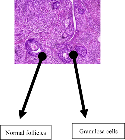 Figure 2 Normal follicular development, with follicles at various stages of development. There are also granulosa cells and basal cells in the control group (group 1) given water as a placebo.