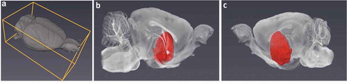 Figure 1. Feasibility of brain lesion characterization in small animals (such as rat) through micro-CT imaging technique. (a) A typical manipulable 3D volume of a rat brain. (b, c) Processed micro-CT images showing a lesion in the context of a rat brain from two viewpoints. Reprinted from open access Ref. [Citation7]. Copyright 2018 Nature Publishing Group.