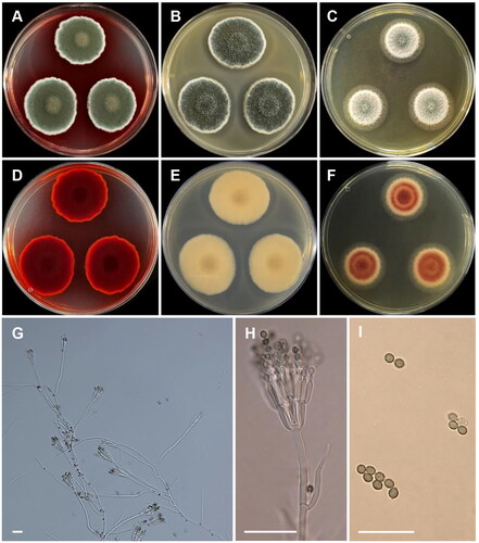 Figure 10. Morphology of Talaromyces atroroseus CNUFC SJ322. (A, D) Colonies on Czapek yeast autolysate agar (CYA); (B, E) malt extract agar (MEA); (C, F) yeast extract sucrose agar (YES) (A–C: obverse view and D–F: reverse view); (G, H) Conidiophores; (I) Conidia. Scale bars: G = 20 µm, H, I = 10 µm.