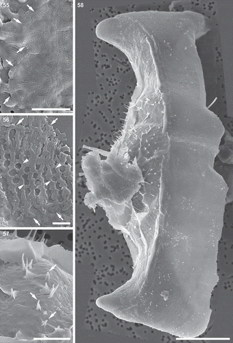 Figs 55–58. Auxospore cell wall and initial cell, scanning electron microscopy. Fig. 55. The ends of the open transverse perizonial bands (arrows). Fig. 56. Segment of transverse perizonial band showing asymmetry across its width (arrows) relative to the loosely defined central rib (arrowheads). Fig. 57. Enlarged detail of initial valve in Fig. 58, showing its spines puncturing transverse perizonial bands (arrows). Fig. 58. An initial frustule shrouded in remnants of the dorsal part of the auxospore wall. Note transverse perizonial bands straddling the initial epivalve, low-topography valve face profile and imperfectly formed apical elevations. This figure is a digitally constructed montage of four individual SEM images. Scale bars: Fig. 55, 10 µm; Fig. 56, 1 µm; Fig. 57, 5 µm; Fig. 58, 20 µm.