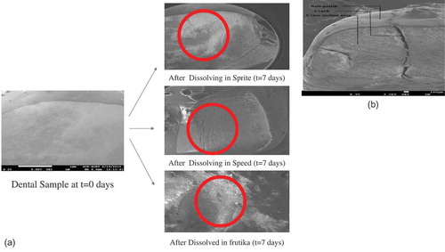 Figure 5. SEM analysis of dental erosion caused by beverages. (a) SEM images were taken before and after dissolution of dental samples in beverages (Fanta, Speed and Frutika) for 10 days; (b) SEM image of cross-section of eroded tooth sample in Sprite.