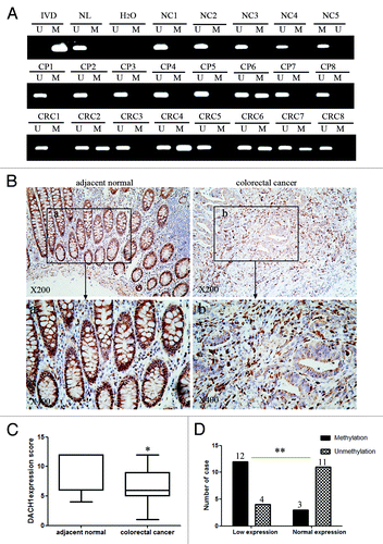 Figure 2. DNA methylation and expression of DACH1 in primary colorectal cancer. (A) Representative MSP results of DACH1 methylation status in normal colon mucosa (NC), colorectal adenomatous polyps (CP) and colorectal cancer tissues (CRC). (B) Representative images of DACH1 protein expression in colorectal cancer and their adjacent non-tumor tissues determined by IHC. (upper images, X200; lower images, X400). (C) DACH1 expression scores are shown as box plots, horizontal lines represent the median score; the bottom and top of the boxes representing the 25th and 75th percentiles, respectively; vertical bars represent the range of data. Expression of DACH1 was different between adjacent normal and tumor tissues in 30-matched primary CRCs. *P < 0.05. (D) The correlation between DACH1 hypermethylation and expression level was analyzed in 30-matched primary CRCs (**P < 0.01).