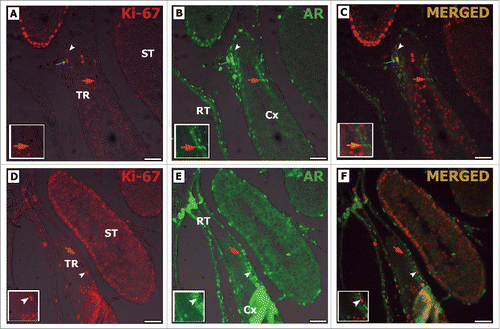 Figure 7. Double-label immunofluorescence for Ki-67 (A, D) and AR (B, E) in pre-pubertal Wistar rats. As it can be observed, AR positive Sertoli cells are Ki-67 negative (orange arrow C, F), while Ki-67 positive Sertoli cells are AR negative (white arrowhead C, F). Peritubular myoid cells were observed in TR expressing Ki-67 and AR (blue arrow C). TR: transition region; Cx: area adjacent to the TR; ST: seminiferous tubules. Bar: 50 μm.