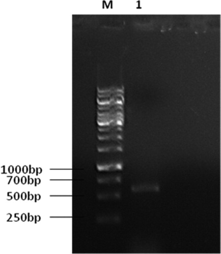 Figure 1. Agarose gel electrophoresis (1% agarose) of PCR amplified products (size 650 bp) using ITS1 and ITS4 PCR primer sets. Lane 1 is C. cladosporioides isolate BOU1 and Lane M is DNA marker (1 kb, Thermo Scientific).