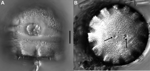 Figure 8  Light micrographs of the cell following the first division of an initial cell of Cavernosa kapitiana from Ile de la Possession. A, Girdle view of a cell with a globular valve and a flat valve. B, Face view of a flat valve with two rimoportulae in the valve centre (arrows). Scale bar, 10 μm.