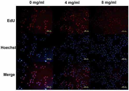 Figure 2. We used EdU staining to detect A549 cell line DNA replication. EdU positive cells was stained red and the nuclei were stained blue. The scale bars indicated 50 μm.