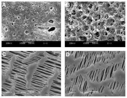 Figure 2 (A) SEM image of surface of obverse of the Ag-nHA-nTiO2/PA66 membrane (×500); (B) SEM image of surface of reverse of the Ag-nHA-nTiO2/PA66 membrane (×500); (C) SEM image of surface of obverse of the e-PTFE membrane (×2000); (D) SEM image of surface of reverse of the e-PTFE membrane (×2000).Abbreviations: e-PTFE, expanded poly tetrafluroethylene; PA66, polyamide-66; SEM, scanning electronic microscope.