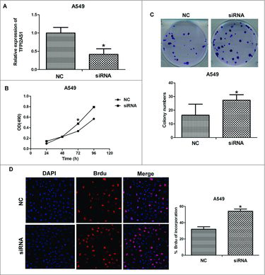 Figure 2. TFPI2AS1 knockdown promotes cell proliferation in A549 cells. (A) A549 cells were transfected with control siRNA or TFPI2AS1 siRNA for 48 h and then cells were harvested for examining efficiency of knockdown. (B) A549 cells transfected with control siRNA or TFPI2AS1 were trypsinized and plated into 96-well plates for MTT assay. (C) Colony formation of A549 cells 14 days after transfection with the indicated oligonucleotides. (D) After transfection with control siRNA or TFPI2AS1 siRNA for 48 h, A549 cell proliferation was measured by a Brdu incorporation assay. The proliferating cells that recently underwent DNA synthesis were labeled with Brdu (red), and total nuclei were visualized by DAPI (blue) staining. % Brdu presented as percent of Brdu incorporated cells within the siRNA-treated A549 cell population. *P < 0.05 vs NC. Data are expressed as the mean ± SD of the experiments performed in triplicate.