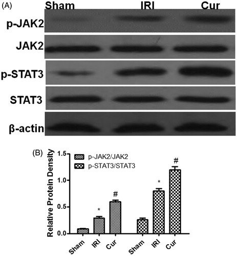 Figure 4. Effects of Curcumin pretreatment on the JAK2/STAT3 signaling after renal ischemia-reperfusion injury. Western blot analysis was employed to the expression of JAK2, p-JAK2, STAT3, and p-STATA3. (A) A representative result for Western blot analysis p-JAK2, STAT3, and p-STATA3. (B) Semi-quantitative analysis of 10 animals studied in each group. The relative amounts of p-JAK2, JAK2, STAT3, and p-STATA3 in each group of rats were normalized by β-actin and presented as a ratio between p-JAK2/JAK2 and p-STAT3/STAT3. *p<.05 (IRI vs. Sham); #p<.05 (Curcumin vs. IRI). (IRI vs. Sham); #p<.05 (Cur vs. IRI).