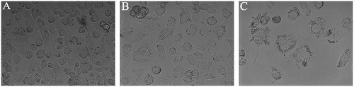 Figure 1. Morphological changes of HK-2 cells after treated with mannitol for 48 h. The cells were observed under an inverted phase contrast microscope with 400 magnification. (A) In control group, cells appeared in a spreading spindle shape. (B, C) After exposing HK-2 cells to 100 or 250 mM for 48 h, the cells became progressively swelling, membrane ruptured and detached. In addition, a remarkable decreased cell density was noticed.
