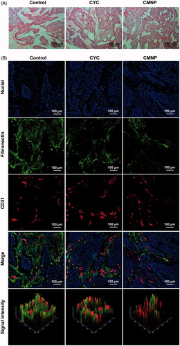 Figure 4. ECM disruptions by CMNP treatment evaluated by (A) H & E staining and (B) immunofluorescence staining (n = 6). After treatment with PBS, CYC or CMNP for 18 days, Capan-2 tumour xenografts were obtained for H&E staining and immunofluorescence staining.