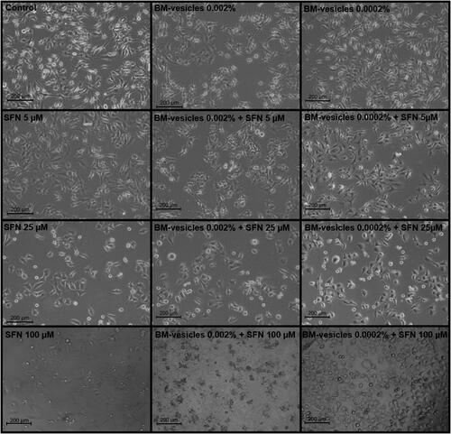 Figure 7. Morphological analysis. Phase-contrast microscopy images of SK-MEL-28 cells treated with different treatments: control, free sulforaphane (SFN) (5, 25, and 100 µM), Broccoli membrane-vesicles (BM-V) (0.002 and 0.0002% protein), and SFN (5, 25, and 100 µM) encapsulated in BM-vesicles (0.002 and 0.0002% protein). Scale bars = 200.