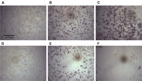 Figure 6 PANC-1 cells exposed to 0, 25, and 50 μg/mL dose of nanoparticles, respectively, without laser irradiation (A–C) and with laser irradiation at 7.9 W/cm2 power density (D–F).
