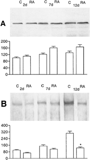 5 Western blot analysis of occludin (A) and ZO-1 (B) in HepG2 cells cultured for 2, 7, and 12 days in the absence (C) or presence of retinoic acid (RA). Densitometric evaluation of the bands, expressed as percentages of controls at two days of culture, shows a decrease in ZO-1 after RA treatment, particularly evident after 12 days (60%). Results are the average of at least four different experiments ±S.D. *P < 0.01.