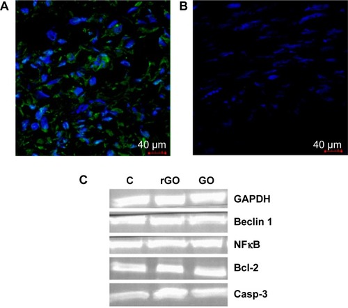 Figure 7 Protein expression level.Notes: (A, B) Visualization of caspase-3 in glioblastoma tumors, shown as an overlaid image of 4′,6-diamidino-2-phenylindole-stained nuclei (blue) and cytoplasm caspase-3 stained with fluorescent secondary antibody 488 Alexa Fluor® (green), in the cross-section of the tumors, visualized using a confocal microscope. (A) rGO-treated tumors, (B) control group, (C) representative immunoblot of caspase-3, Beclin 1, Bcl-2, and nuclear factor kappa B protein expression levels.Abbreviations: C, control group; Casp-3, caspase-3; GAPDH, glyceraldehyde-3-phosphate dehydrogenase; GO, graphene oxide; rGO, reduced graphene oxide; NFκB, nuclear factor kappa B.