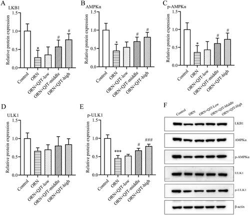 Figure 4. QJT regulated LKB1/AMPK signaling pathway in ORN-treated rats. (A–E) Relative protein levels of LKB1 (A), AMPKα (B), p-AMPKα (C), ULK1 (D), and p-ULK1 (E) were examined by western blotting. (F) Representative images of western blotting protein bands. Data were expressed after being normalized to β-actin. *p < 0.05 vs. Control group. #p < 0.05 vs. ORN group. All assays were performed five times.