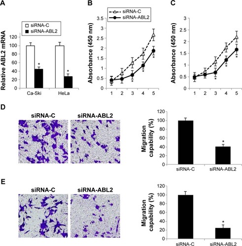 Figure 5 ABL2 downregulation reduced in vitro proliferation and migration in cervical carcinoma.