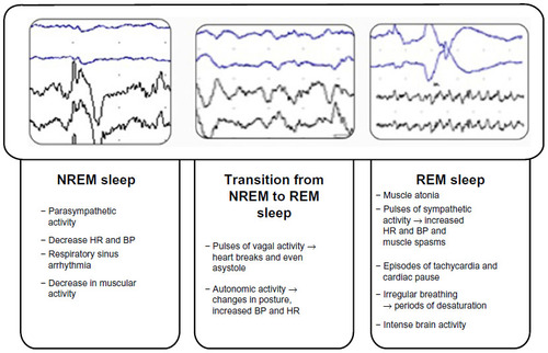 Figure 1 Physiological changes that occur during sleep phases.