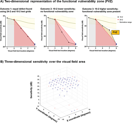 Figure 1. Schematic of the models developed in the present study. In A: the Functional Vulnerability Zone (FVZ) concept is shown using a two dimensional representation of sensitivity (y-axis) as a function of test location (x-axis). The outcomes are dependent on the relative relationship between sensitivities obtained using the 24-2 (red) and 10-2 (black), relative to a normative distribution from the authors’ previous publication (yellow zone), as described in the text. The FVZ is highlighted using the orange bars in outcome 3 (right panel). In B: 24-2 (red crosses) and 10-2 (blue circles) for a representative patient are shown for visual field sensitivity as a function of test location (x and y locations).