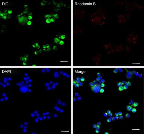 Figure 4 Fluorescent colocation of PRP with MKN45 cells.Notes: Representative immunofluorescence images of MKN45 cells, which were stained with DAPI (blue). Anti-EGFR-iRGD was prestained with Rhodamine B (red), RBCm-PTX was prestained with DiO (green), scale bar=20 μm. PRP, PTX-loaded RBCm-derived microvesicles functionalized with anti-EGFR-iRGD.Abbreviations: DiO, 3,3′-dioctadecyloxacarbocyanine perchlorate; PTX, paclitaxel; RBC, red blood cell; RBCm, RBC membrane.