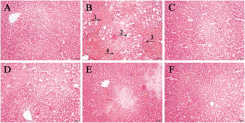 Figure 1. The pathological sections of liver tissue of rats among diverse groups (×200): (A) the control group (CG); (B) the model group (MG); (C) the Bifendatatum positive control group (PCG); (D) the low dose group of RG (LRGG); (E) the medium-dose group of RG (MRGG); (F) the high dose group of RG (HRGG). (1. The size and morphology of hepatocytes were abnormal; 2. There were lots of vacuoles; 3. The shape of the liver cord was changed; 4. The hepatic sinusoid was fuzzy).