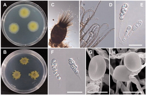 Figure 6. Morphology of C. carteri CNUFC-NDR3-1. (A), Colonies in potato dextrose agar (PDA). (B), Colonies in malt extract agar (MEA). (C), Ascomata mounted in lactophenol. (D), Tip of terminal hairs. (E,F), Asci containing ascospores. (G,H), Ascospores. (C– F: observed under light microscope; G, H: observed under SEM) (scale bars E, F = 20 µm; G, H = 5 µm).