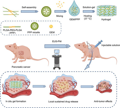 Scheme 1 Schematic representation of the sustained delivery of gemcitabine (GEM) through a biodegradable thermo-sensitive hydrogel (PLGA-PEG-PLGA, PPP). This injectable hydrogel allows for direct administration into pancreatic cancer via endoscopic ultrasound-guided fine needle injection (EUS-FNI) and facilitates sustained local drug delivery of GEM to exert an anti-tumor effect.