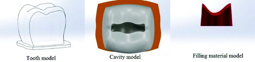 Figure 1. Tooth, inlay cavity and filling material model.