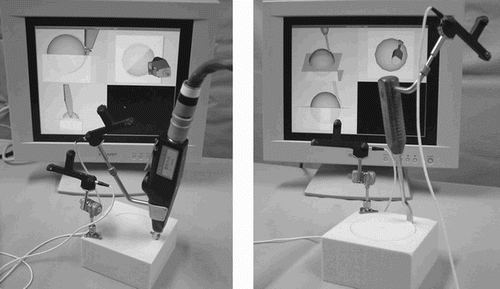 Figure 3. Hemispherical osteotomy with curved-bladed Tuke Saw® (left) or curved chisel (right) under optical navigation.