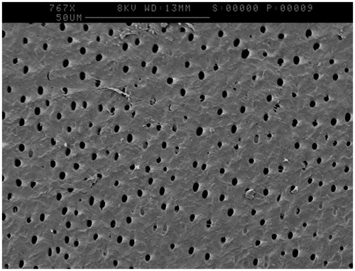 Figure 1. Patent dentine tubules following etching of the dentine surface with 6% citric acid for 90 seconds.
