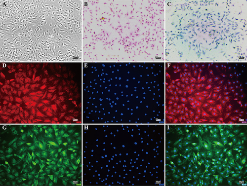 Figure 1 Morphological examination of NPCs. (A) Morphology of nucleus pulposus cells (NPCs) observed under an optical inverted microscope. (B) Hematoxylin and eosin staining revealed blue nuclei and pink cytoplasm in NPCs. (C) Toluidine blue staining showed dark blue nuclei and light blue cytoplasm in NPCs. (D-F) Collagen II immunofluorescence staining exhibited red fluorescence in NPCs. (G-I) Aggrecan immunofluorescence staining displayed green fluorescence in NPCs. The scale for (A-C) is 100μm, while the scale for (D-I) is 20μm.