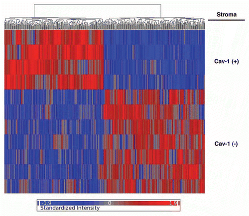 Figure 1 Stromal Cav-1 can be used to stratify human breast cancer patients into two transcriptionally distinct patient populations. The transcriptional profiles of Cav-1-positive (+) tumor stroma (N = 4) versus Cav-1-negative (−) tumor stroma (N = 7) were compared. We identified 238 gene transcripts that were upregulated and 232 gene transcripts that were downregulated in the stroma of tumors showing a loss of Cav-1 expression (Sup. Table 1). Note that the two patient populations are transcriptionally different. One-way ANOVA was setup to extract differentially expressed genes between Cav-1 positive and Cav-1 negative samples. The resultant p-values were further adjusted by multi-test correction (MTC) method of FDR step-up. The standardized intensity data from the stringent gene list (p-value ≤ 0.01 and fold change ≥1.5) were used in generating the hierarchical clustering HeatMap.