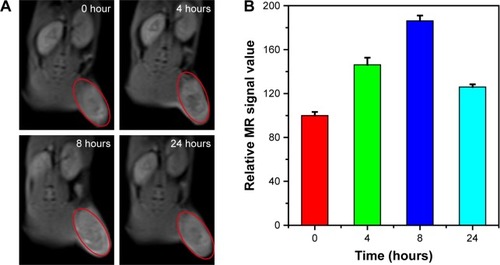 Figure 6 (A) Time-dependent in vivo MR imaging and (B) corresponding MR signal intensities in 4T1 tumor-bearing mice before (0 hour) and after (4–24 hours) intravenous injection of Cu5FeS4 cube nanoparticles.Abbreviation: MR, magnetic resonance.