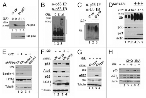 Figure 2. Mutant p53 is deacetylated during GR, and its degradation is regulated by autophagy. (A) Cell extracts derived from MDA-231 cells grown in the presence (lanes 1 and 2) or absence of glucose for 8 h (lane 3) or for 16 h (lane 4) were first equalized for p53 content with a first immunoblot of total p53, then were immunoprecipitated with a mixture of anti-acetyl-p53 antibody (K373 and K320, lanes 1–3), followed by immunoblot with the monoclonal anti-p53 antibody. Lane 1 shows a control immunoprecipitation reaction from untreated cell extracts. The lower panel shows the total p53 inputs used for the immunoprecipitation reactions. (B) Cell extracts as in (A) were immunoprecipitated with agarose-conjugated anti-p53 monoclonal antibody (DO1). The products of these immunoprecipitation reactions were then probed with an anti-goat anti-p53 polyclonal antibody. The lower panel shows a short exposure of the anti-p53 immunoblot. In (C), extracts derived from untreated (lane 2) or GR-treated cells (lanes 1 and 3) were immunoprecipitated with agarose-conjugated anti-p53 antibody (lane 2 and 3), or with a control isotope-matched antibody (lane 1, indicated ctr. IP) and probed in immunoblot with anti-ubiquitin antibodies. Brackets in (B and C) indicate the position of high molecular weight isoforms that react with both anti-p53 and anti-ubiquitin antibodies. (D) MDA-231 cells were grown in regular or GR media for the indicated time, and in the absence (lanes 1–3) or presence (lanes 4–6) of 20 μM MG132 for 16 h. Immunoblots with anti-p53, anti-ubiquitin (Ub), anti-actin or anti-p21 antibodies are shown. (E) MDA-231 cells were transfected with 50 nM of control siRNA (lanes 1 and 2) or with 50 nM of the siRNA specific for Beclin-1 (lane 3 and 4) in the presence (lanes 1 and 3) or absence (lanes 2 and 4) of glucose. Cell extracts were probed with the antibodies indicated at the left of each panel. The two LC3 isoforms, microtubule- (LC3-I; 18 kDa) and autophagosome associated (LC3-II, 16 kDa), are indicated. (F–G) Untreated (lanes 1 and 2 of each panel) or GR-treated (lanes 3 and 4) MDA-231 cells were transfected with control shRNAs (lanes1–3) or with the shRNAs (lanes 2–4, each panel) specific for ATG5 (F) or ATG7 (G). The expression levels of p53, ATG5, ATG7, p62 or LC3 are shown. (H) Cells were cultured in regular media (lanes 1, 3 and 5) or in GR media (lanes 2, 4 and 6) for 16 h. Cells received either chloroquine (20 μM; lanes 3 and 4) or 3MA (5 mM, lanes 5 and 6) for the last 4 h of incubation. p53, LC3 and actin levels were assessed.