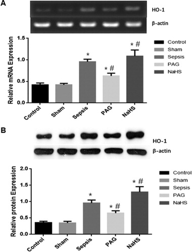 Figure 3. Expression levels of HO-1 in renal tissues. The mRNA (A) and protein (B) expression levels of HO-1 were detected with SqRT-PCR and Western blot analysis, respectively. Compared with the Control group, *P < 0.05; compared with the Sepsis group, #P < 0.05.