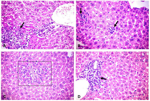 Figure 2 Histopathological changes in liver of challenged mice. (A) Liver showing patchy area of hepatic cellular necrosis mixed with polymorph nuclear and mononuclear inflammatory cells (arrow), portal congestion, bile duct hyperplasia and leukocytic aggregations mostly, with neutrophils, macrophages and lymphocytes (H&E X400). (B) Liver showing multiple focal areas of hepatocellular necrosis with neutrophils (arrows) and few mononuclear cell aggregation, sinusoidal dilation and kupffer cells activation (H&E X400). (C) Liver showing focal area of hepatic cellular necrosis (rectangle) mixed with polymorph nuclear, mononuclear inflammatory cells and fragmented nuclei (H&E X400). (D) Liver showing intense periportal inflammatory cell aggregation (arrow) (H&E X400). H&E, hematoxylin and eosin stain.